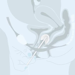 Medizintechnik Heise - Contrelle Activgard